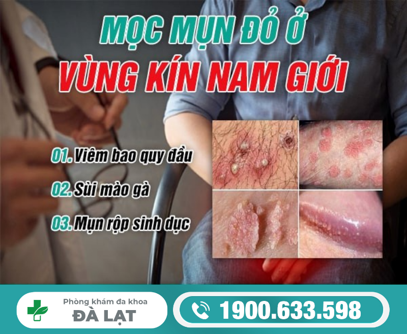 Hình ảnh minh họa